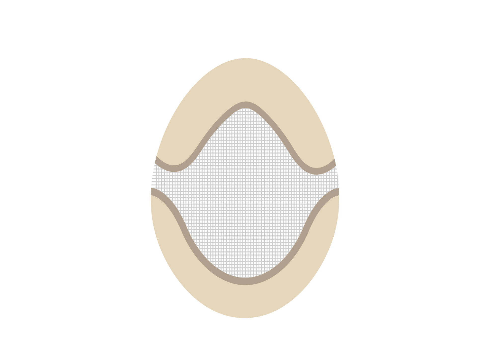 M15: Lace Hair System with PU Perimeter